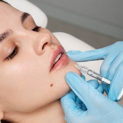 Best Lip Fillers Injections Muscat