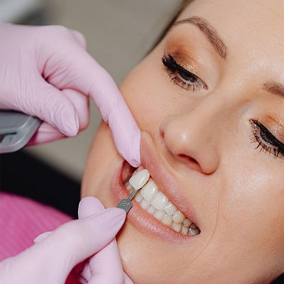 Dental Veneers in Dubai