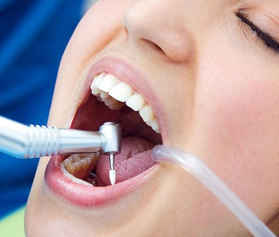 Can Deep Cleaning Help With Loose Teeth?