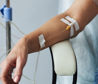 شرح مبسط للعلاج بالتنقيط الوريدي