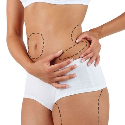 Vaser 4D Liposuction in Oman
