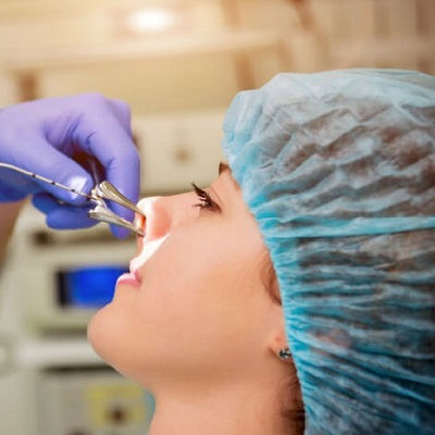 Best Septoplasty & Turbinate Reduction Muscat