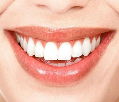 The Benefits of Zoom Teeth Whitening in Dubai
