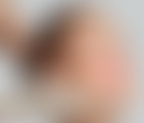 شرح جراحة تجميل الفك