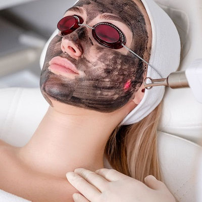 Best Laser Carbon Peel in Oman
