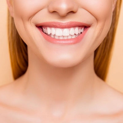Hollywood Smile Design in Dubai
