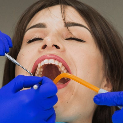 Full Mouth Rehabilitation in Dubai