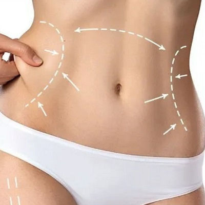 Best Fat Melting Injections Muscat