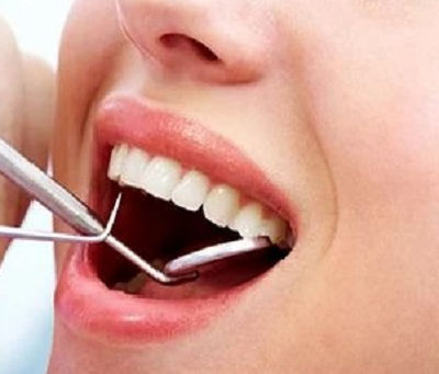 The Benefits of Choosing Composite Fillings Over Amalgam in Dubai