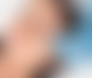 علاج حب الشباب لبشرة تتعافى بشكل أسرع