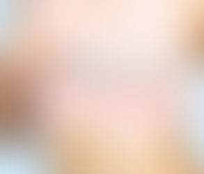 نتائج عملية شد الثدي: ما يمكن أن تتوقعه المريضات