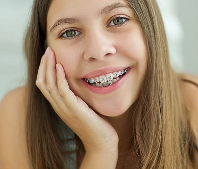 What Happens After Braces Are Removed?