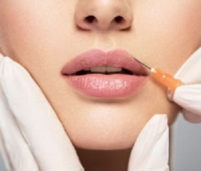How JUVÉDERM VOLBELLA Can Help Restore Youthful Fullness to Your Lips