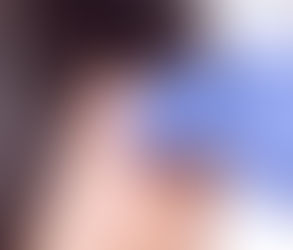 فهم فوائد تقنيات إعادة تشكيل الأذن الحديثة