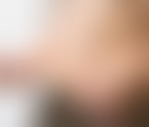 حقن ويجوفي ومجموعات الدعم: هل تحتاج إلى واحدة؟