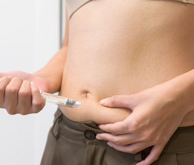 حقن ويجوفي ومجموعات الدعم: هل تحتاج إلى واحدة؟