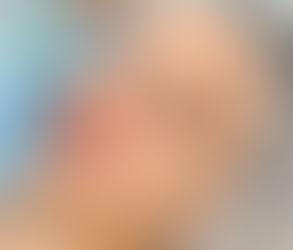 خيارات الجراحة التجميلية للحصول على نتائج طبيعية المظهر