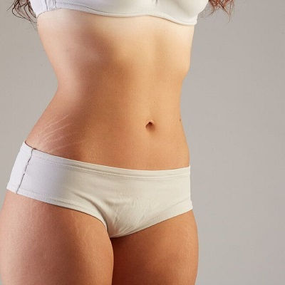 Post Weight Loss Clinic in Muscat