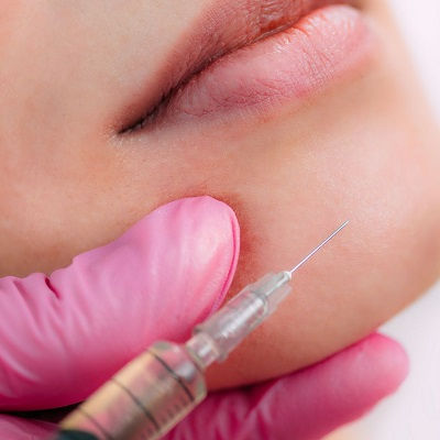Chin Fillers in Muscat
