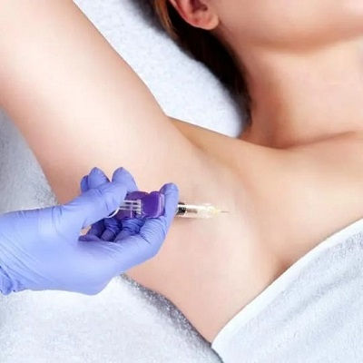 Hyperhidrosis Treatment in Muscat