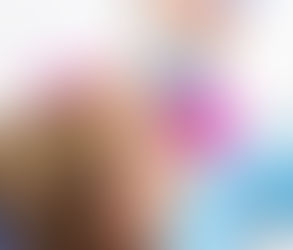 Posterior Root Canal for Molars: Is It Necessary?