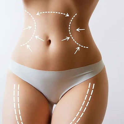 Vaser 4D Liposuction in Oman