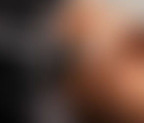 فهم خطوة الترطيب في علاج هايدرافيشال