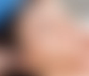 نصائح حول حقن البوتوكس للحصول على بشرة شابة