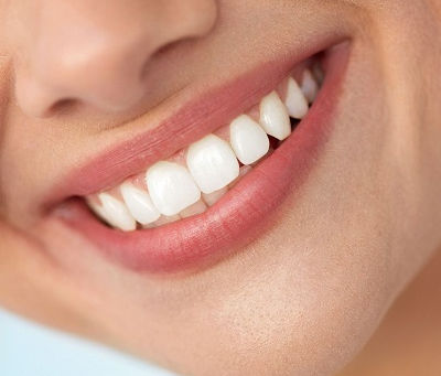 Customizing Your Perfect Smile: Digital Smile Design Solutions in Dubai