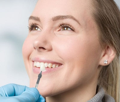 Dental Veneers for Stained Teeth: Solutions That Work