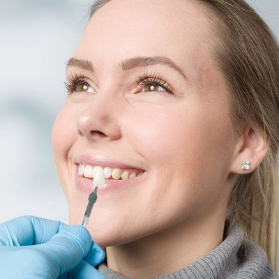 Dental Veneers in Dubai