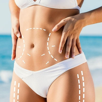 Vaser 4D Liposuction Clinic in Muscat
