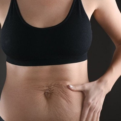Best Post Weight Loss Oman