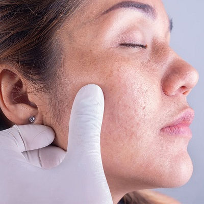 Best Dermatologist Muscat