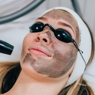 Laser Carbon Peel in Oman