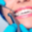 When to See a Periodontist After Cleaning