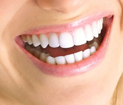 Can You Swim After Getting E-Max Veneers?