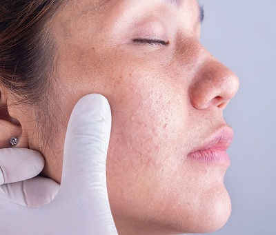 Top 10 Skincare Myths: What Dermatologists Wish You Knew
