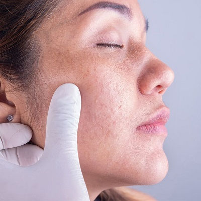 Best Dermatologist Muscat