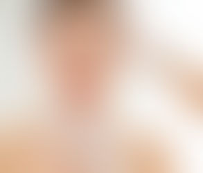 Can a Dermatologist Help with Dry, Itchy Skin?