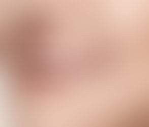 Teeth Whitening Cost With Guaranteed Results