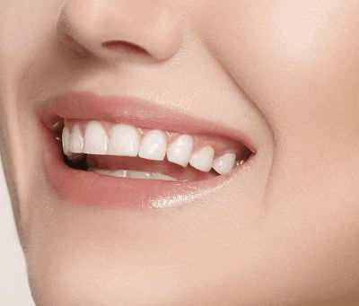 Teeth Whitening Cost With Guaranteed Results