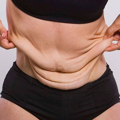 Bariatric Surgery in Muscat