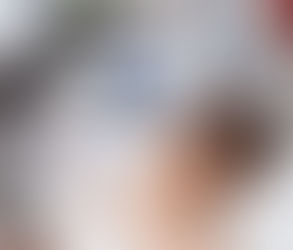 هل يُجدي تقشير الكربون بالليزر على البشرة الداكنة؟