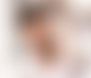Medications to Take (and Avoid) After a Hair Transplant