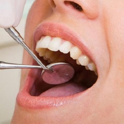 Full Mouth Rehabilitation in Dubai