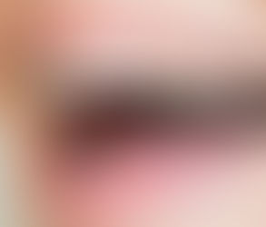 Dental Appliances: A Complete Guide for Beginners