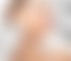 The Art of the Perfect Jawline with Dermal Fillers