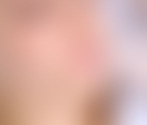 Is Lip Blushing a Better Alternative to Fillers?