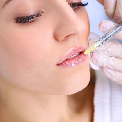 Lip Fillers Injections in Muscat